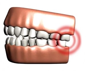 Removal of wisdom teeth by a trained dentist in Carrollton can help alleviate eventual pain and infection.
